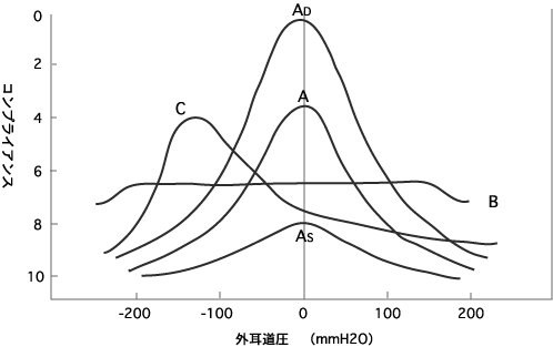 ティンパノメトリ－